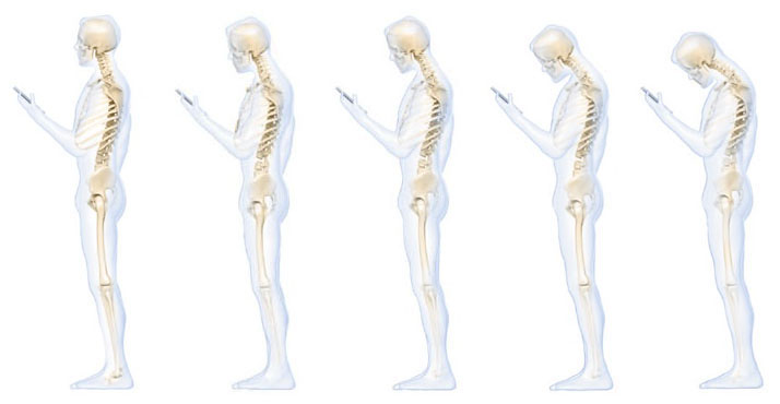 © Kenneth Hansraj/Surgical Technology International © Kenneth Hansraj/Surgical Technology International