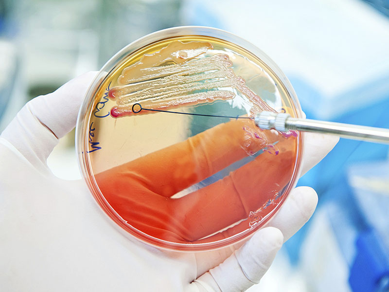 escherichia-coli-bakterien-auf-Datenträger